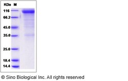 Sino Biological Rat CD36 Protein 100ug (Sino Biological), Quantity: Each