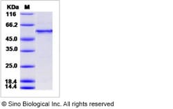 Sino Biological Human CDC2 & CCNE1 Protein 50ug (Sino Biological), Quantity: