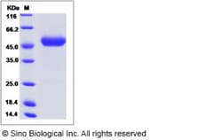 Sino Biological Rat SerpinE1 Protein 100ug (Sino Biological), Quantity: