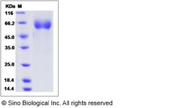 Sino Biological Rhesus IL12A Protein 50ug (Sino Biological), Quantity:
