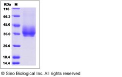 Sino Biological Rat PDCD1LG2 Protein 100ug (Sino Biological), Quantity: