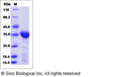 Sino Biological Rat HAAO Protein 100ug (Sino Biological), Quantity: Each