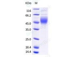 Sino Biological Human CD244 Protein 100ug (Sino Biological), Quantity:
