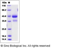 Sino Biological Recombinant Cynomolgus ACVR1 Protein (hFc Tag), Quantity: