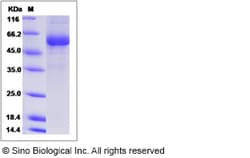 Sino Biological Cynomolgus TNFSF11 Protein 100ug (Sino Biological), Quantity: