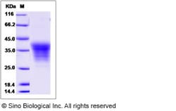 Sino Biological Cynomolgus EDAR Protein 100ug (Sino Biological), Quantity: