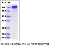 Sino Biological Rat SEMA4D Protein 100ug (Sino Biological), Quantity: Each
