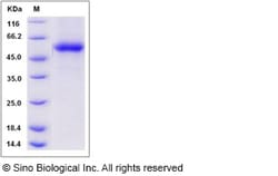 Sino Biological Recombinant Rat TL1A/TNFSF15 Protein (hFc Tag), Quantity: