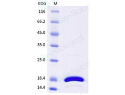 Sino Biological Human IL21 Protein 1MG (Sino Biological), Quantity: Each
