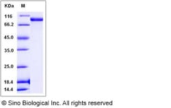 Sino Biological Rat COLEC12 Protein 100ug (Sino Biological), Quantity: