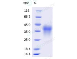 Sino Biological Rhesus PDCD1 Protein 100ug (Sino Biological), Quantity:
