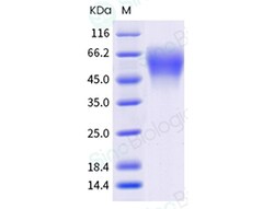 Sino Biological Human CEACAM8 Protein 1MG (Sino Biological), Quantity: