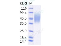Sino Biological Cynomolgus CD226 Protein 1MG (Sino Biological), Quantity: