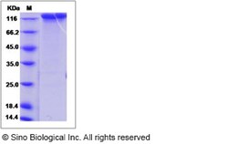 Sino Biological Recombinant Rhesus EGFR Protein (ECD, hFc Tag), Quantity:
