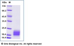 Sino Biological Human IL5 Protein 1MG (Sino Biological), Quantity: Each