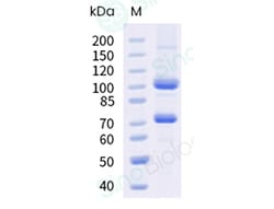 Sino Biological Recombinant Human Complement C5 Protein (Flag Tag), Quantity:
