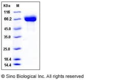 Sino Biological Mouse BCHE Protein 50ug (Sino Biological), Quantity: Each