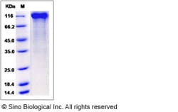 Sino Biological Rhesus CD22 Protein 50ug (Sino Biological), Quantity: Each