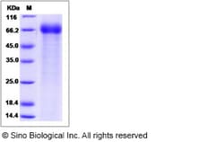 Sino Biological Cynomolgus ART4 Protein 50ug (Sino Biological), Quantity: