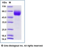 Sino Biological Cynomolgus IL1RL1 Protein 1MG (Sino Biological), Quantity: