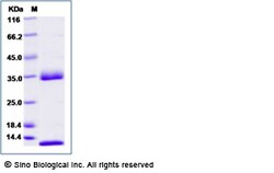 Sino Biological Cynomolgus FCGRT & B2M Protein 20ug (Sino Biological),