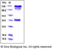 Sino Biological Human BACE1 Protein 1MG (Sino Biological), Quantity: Each
