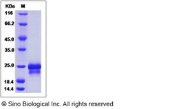 Sino Biological Human PRAC1 Protein 50ug (Sino Biological), Quantity: Each