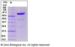 Sino Biological Human CPE Protein 50ug (Sino Biological), Quantity: Each