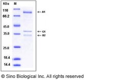 Sino Biological PRKAG1/PRKAB1/PRKAA1 Protein 50ug (Sino Biological), Quantity: