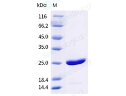 Sino Biological Ves v 5 Protein 250ug (Sino Biological), Quantity: Each