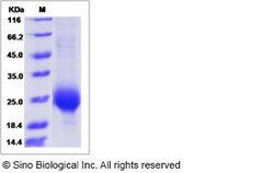 Sino Biological Recombinant Cynomolgus ALK-1 Protein (ECD, His Tag), Quantity: