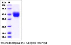 Sino Biological Rat CD14 Protein 100ug (Sino Biological), Quantity: Each