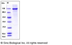 Sino Biological Human ACO2 Protein 50ug (Sino Biological), Quantity: Each