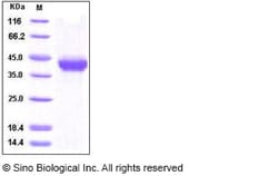 Sino Biological Human AGRP Protein 50ug (Sino Biological), Quantity: Each