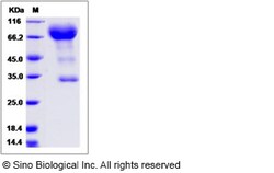 Sino Biological Rat PROM1 Protein 100ug (Sino Biological), Quantity: Each