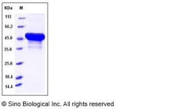 Sino Biological Mouse BLMH Protein 50ug (Sino Biological), Quantity: Each