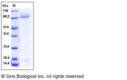 Sino Biological Human PGA4 Protein 50ug (Sino Biological), Quantity: Each
