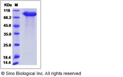 Sino Biological Rhesus AMY2A Protein 100ug (Sino Biological), Quantity: