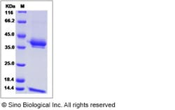 Sino Biological Cynomolgus CD1E & B2M Protein 100ug (Sino Biological),