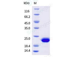 Sino Biological COPZ1 Protein 100ug (Sino Biological), Quantity: Each of