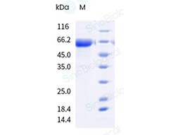Sino Biological H3N2 NA Protein 100ug (Sino Biological), Quantity: Each