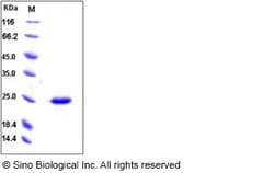 Sino Biological Human SDF2 Protein 100ug (Sino Biological), Quantity: Each