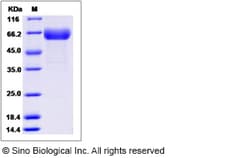 Sino Biological Rat CD276 Protein 100ug (Sino Biological), Quantity: Each