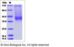 Sino Biological Recombinant Cynomolgus IL-7R alpha/CD127 Protein (His Tag),