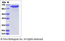 Sino Biological Rat IL6R Protein 100ug (Sino Biological), Quantity: Each
