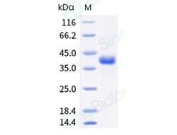 Sino Biological Recombinant Human R-Spondin 1/RSPO1 Protein, HPLC-verified,