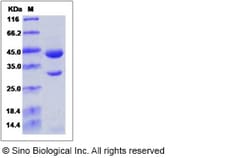 Sino Biological Cynomolgus PDGFB Protein 100ug (Sino Biological), Quantity: