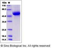 Sino Biological Rat DDR1 Protein 100ug (Sino Biological), Quantity: Each