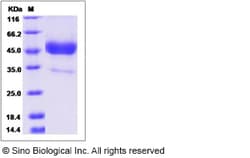 Sino Biological Cynomolgus TSPAN7 Protein 100ug (Sino Biological), Quantity: