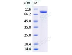 Sino Biological H1N1 HA Protein 100ug (Sino Biological), Quantity: Each